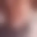 Chat med  mophomee80184